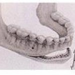 orthodontic-treatment83-150x150