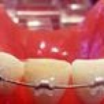 orthodontic22-150x150