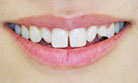 toothcosmetic04